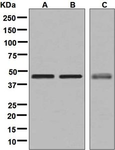 Western blot analysis on (A) HeLa, (B) Jurkat, and (C) LNCaP cell lysates using anti-DPF2 antibody.