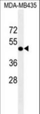 DPF2 antibody western blot of MDA-MB435 cell line lysates (35 ug/lane). The DPF2 antibody detected the DPF2 protein (arrow).