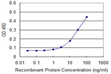 Detection limit for recombinant GST tagged RCN1 is approximately 1 ng/ml as a capture antibody.