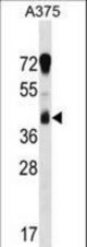 RCN1 Antibody western blot of A375 cell line lysates (35 ug/lane). The RCN1 antibody detected the RCN1 protein (arrow).