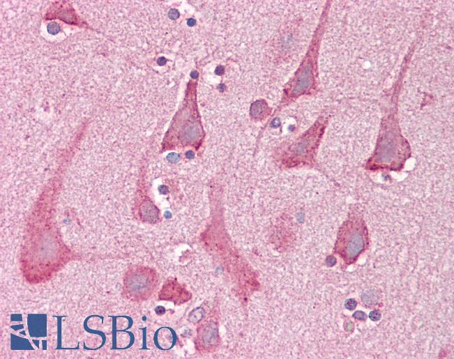 Anti-ROCK1 antibody IHC of human brain, cortex. Immunohistochemistry of formalin-fixed, paraffin-embedded tissue after heat-induced antigen retrieval. Antibody LS-B7100 concentration 5 ug/ml.