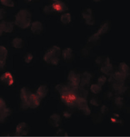 Immunofluorescence of ROCK1 in 293 cells with ROCK1 antibody at 20 ug/ml.