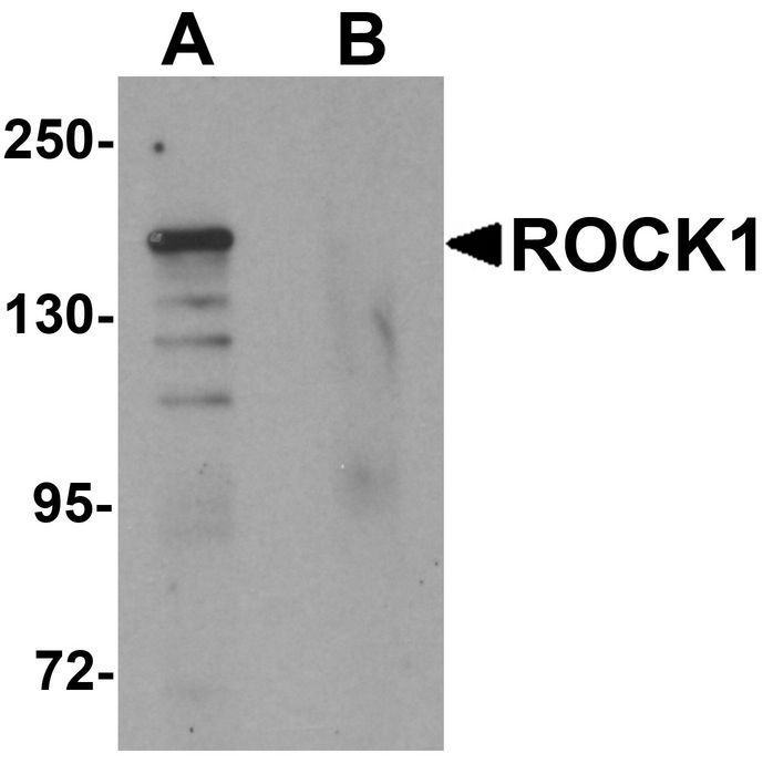 Western blot analysis of ROCK1 in 293 cell lysate with ROCK1 antibody at 1 ug/ml in (A) the absence and (B) the presence of blocking peptide.