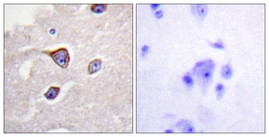 IHC of paraffin-embedded human brain, using GRK1 (Phospho-Ser21) Antibody. The sample on the right was incubated with synthetic peptide.