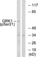 Western blot of extracts from COS7 cells treated with TNF 20ng/ml 5', using GRK1 (Phospho-Ser21) Antibody. The lane on the right was incubated with synthetic peptide.