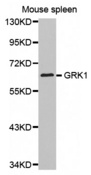 Western blot analysis of extracts of Mouse spleen tissue lysate, using GRK1 antibody.