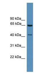 Rhodopsin Kinase / GRK1 antibody Western Blot of Jurkat.