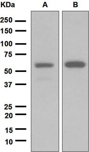 Western blot analysis on (A) Y79 and (B) JAR cell lysates using anti-GRK1 antibody.