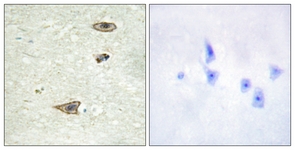 IHC of paraffin-embedded human brain tissue, using GRK1 (Ab-21) Antibody. The picture on the right is treated with the synthesized peptide.