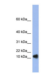 RNASE1 / Ribonuclease A antibody LS-C110520 Western blot of Fetal Spleen lysate.