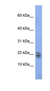 RNASE1 / Ribonuclease A antibody LS-C110519 Western blot of Fetal Kidney lysate.