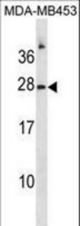 RNASE1 Antibody western blot of MDA-MB453 cell line lysates (35 ug/lane). The RNASE1 antibody detected the RNASE1 protein (arrow).