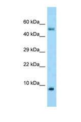 S100A10 antibody LS-C146495 Western blot of Fetal Lung lysate. Antibody concentration 1 ug/ml.