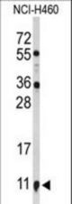 Western blot of S100A10 Antibody in NCI-H460 cell line lysates (35 ug/lane). S100A10 (arrow) was detected using the purified antibody.