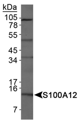 S100A12 Antibody - Detection of S100A12 in HeLa whole cell extracts.