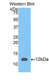 Western blot of recombinant S100A12 / CGRP.