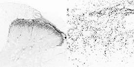 Immunohistochemistry: Vibratome (70 mu m) sections of rat spinal cord immunostained with sheep polyclonal antiserum to CGRP at a dilution of 1:1000. Negative images of fluorescence detection procedure (Alexa488 conjugated secondary antibody). Micrograph courtesy of Professor Andrew Todd (University of Glasgow).