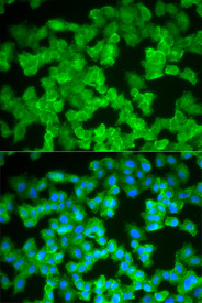 Immunofluorescence analysis of HeLa cell using S100A12 antibody. Blue: DAPI for nuclear staining.
