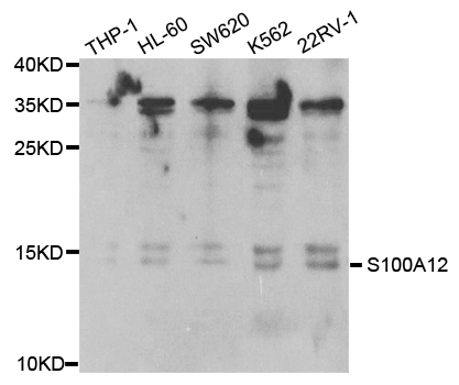 Western blot analysis of extracts of various cell lines, using S100A12 antibody.