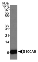 S100A6 Antibody Detection of S100A6 antibody in Hela whole cell extracts.
