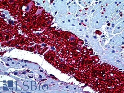 Anti-S100A6 antibody IHC of human colon, myenteric plexus. Immunohistochemistry of formalin-fixed, paraffin-embedded tissue after heat-induced antigen retrieval. Antibody LS-B5204 dilution 1:50.