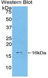 Western blot of recombinant S100A6.