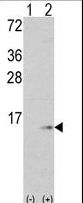 Western blot of S100A6 (arrow) using rabbit polyclonal S100A6 Antibody.293 cell lysates (2 ug/lane) either nontransfected (Lane 1) or transiently transfected with the S100A6 gene (Lane 2) (Origene Technologies).