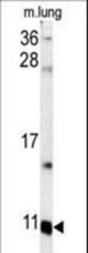 Western blot of S100A6 antibody in mouse lung tissue lysates (35 ug/lane). S100A6 (arrow) was detected using the purified antibody.