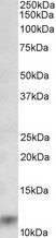 S100A8 antibody (0.03 ug/ml) staining of Human Lung lysate (35 ug protein in RIPA buffer). Primary incubation was 1 hour. Detected by chemiluminescence.