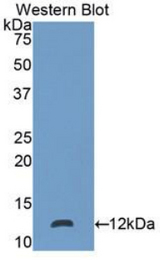 Western blot of recombinant S100P.
