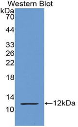 Western blot of recombinant S100P.
