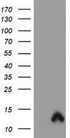 HEK293T cells were transfected with the pCMV6-ENTRY control (Left lane) or pCMV6-ENTRY S100P (Right lane) cDNA for 48 hrs and lysed. Equivalent amounts of cell lysates (5 ug per lane) were separated by SDS-PAGE and immunoblotted with anti-S100P.