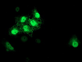 Anti-S100P mouse monoclonal antibody immunofluorescent staining of COS7 cells transiently transfected by pCMV6-ENTRY S100P.