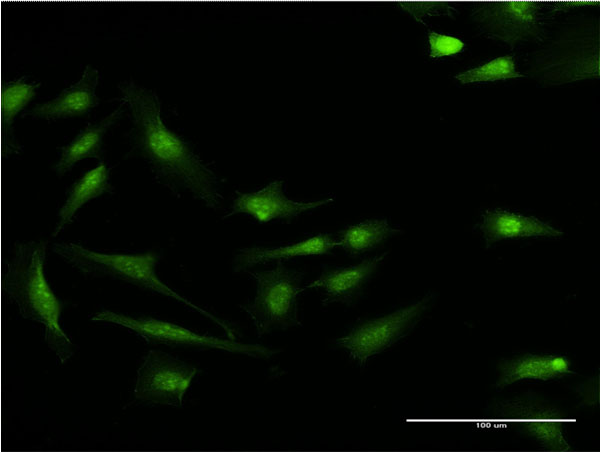 Immunofluorescence of monoclonal antibody to S100P on HeLa cell . [antibody concentration 10 ug/ml]