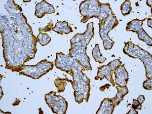 IHC of paraffin-embedded human placenta tissue using anti-S100P antibody.