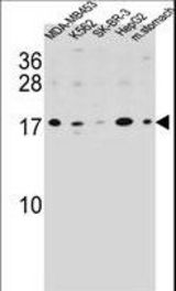 S100Z Antibody western blot of MDA-MB453,K562,SK-BR-3,HepG2 cell line and mouse stomach tissue lysates (35 ug/lane). The S100Z antibody detected the S100Z protein (arrow).