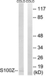 Western blot of extracts from COLO cells, using S100Z Antibody. The lane on the right is treated with the synthesized peptide.