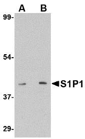 Western blot of S1P1 in mouse thymus lysate with S1P1 antibody at (A) 1 and (B) 2 ug/ml.