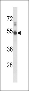 Western blot of hEDG1-I25 in mouse lung tissue lysates (35 ug/lane). EDG1 (arrow) was detected using the purified antibody.