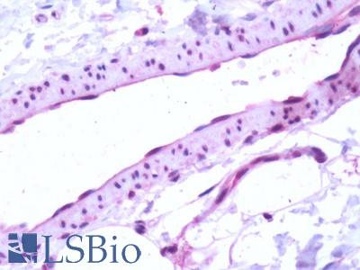 Human, Vascular Endothelium: Formalin-Fixed Paraffin-Embedded (FFPE)
