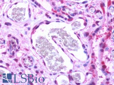 Human, Placenta: Formalin-Fixed Paraffin-Embedded (FFPE)
