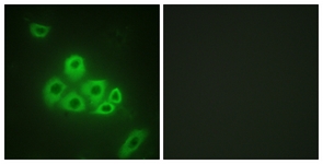 Immunofluorescence of A549 cells, using S1P Receptor EDG1 (Ab-236) Antibody. The picture on the right is treated with the synthesized peptide.