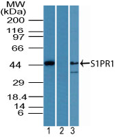 Western blot of S1PR1 in human kidney lysate in the 1) absence, 2) presence of immunizing peptide and 3) rat kidney lysate using S1PR1 antibody at 5 ug/ml. Goat anti-rabbit Ig HRP secondary antibody, and PicoTect ECL substrate solution, were used for this test.