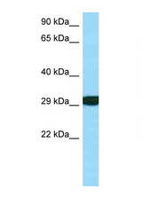 RPS3 antibody LS-C146497 Western blot of Fetal Kidney lysate. Antibody concentration 1 ug/ml.