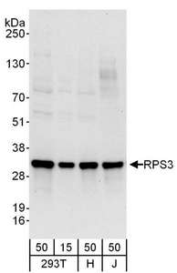 Detection of Human RPS3 by Western Blot. Samples: Whole cell lysate from 293T (15 and 50 ug), HeLa (H; 50 ug), and Jurkat (J; 50 ug) cells. Antibodies: Affinity purified rabbit anti-RPS3 antibody used for WB at 0.1 ug/ml. Detection: Chemiluminescence with an exposure time of 10 seconds.