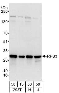 Detection of Human RPS3 by Western Blot. Samples: Whole cell lysate from 293T (15 and 50 ug), HeLa (H; 50 ug) and Jurkat (J; 50 ug) cells. Antibodies: Affinity purified rabbit anti-RPS3 antibody used for WB at 0.1 ug/ml. Detection: Chemiluminescence with an exposure time of 10 seconds.