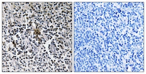IHC of paraffin-embedded human tonsil tissue, using RPS3 Antibody. The picture on the right is treated with the synthesized peptide.