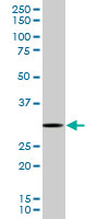 RPS3 monoclonal antibody (M03), clone 2A8. Western Blot analysis of RPS3 expression in HeLa NE.
