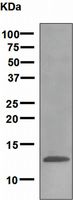 Western blot analysis on human plasma using anti-SAA4 antibody.