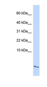 SAA4 antibody LS-C110680 Western blot of Fetal Lung lysate.